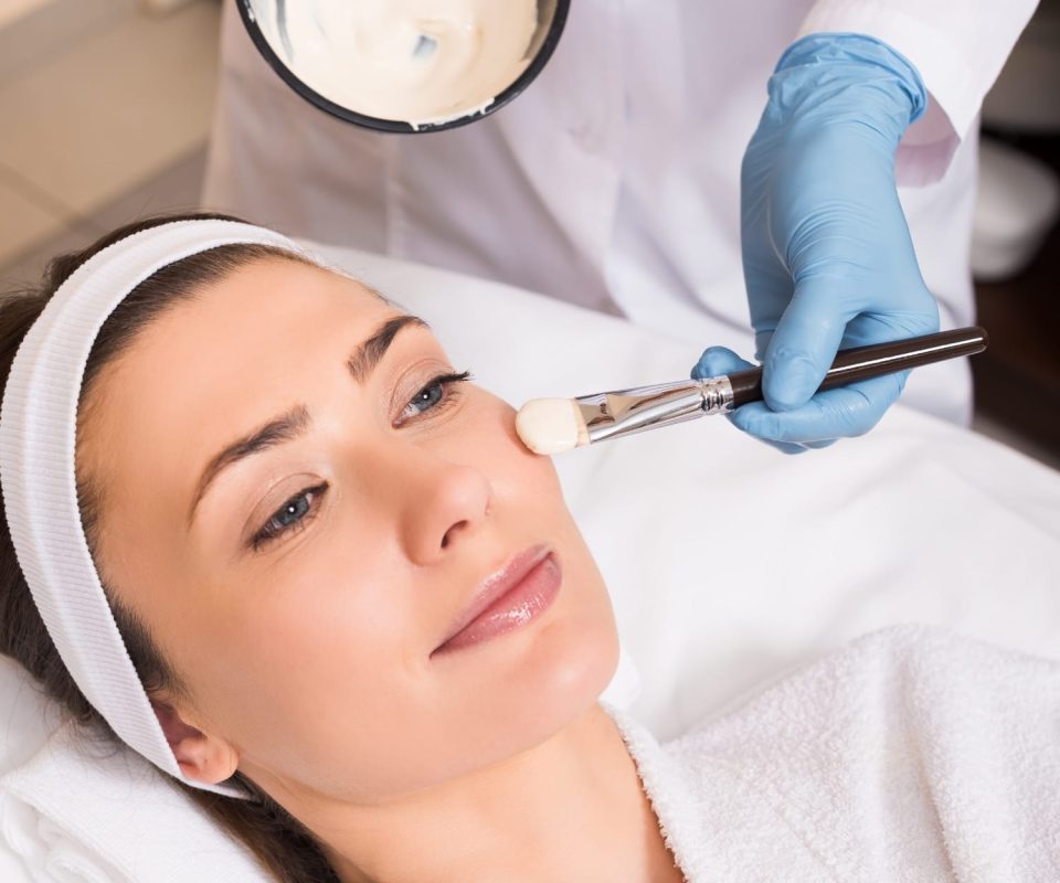 chemical peels featuring